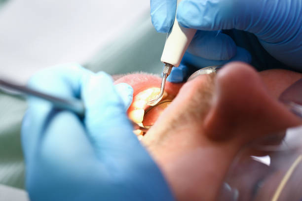 Best Broken Tooth Emergency  in Forest Park, GA