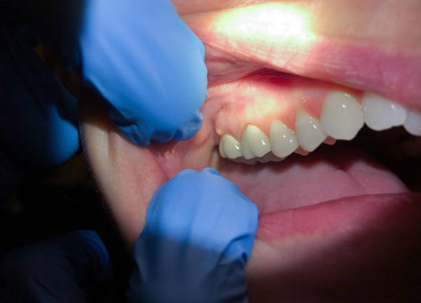 Best Same-Day Dentist Appointment  in Forest Park, GA
