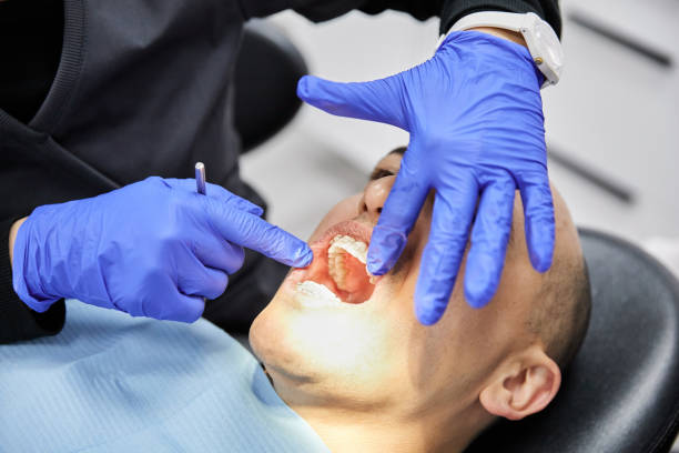 Best Teeth Whitening  in Forest Park, GA